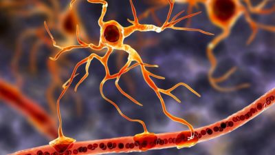 3D illustration of human brain neural cell Astrocyte - CNS Clinical Trials | Amarex