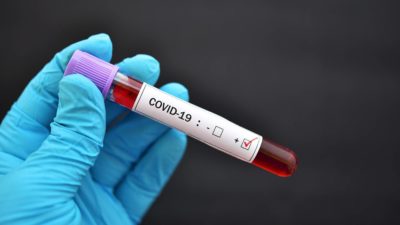 Tube with COVID- 19 positive blood sample - COVID-19 Clinical Product Development Services | Amarex